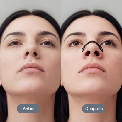 KIT Dilatador Nasal Magnético NEXAIR (30 días)